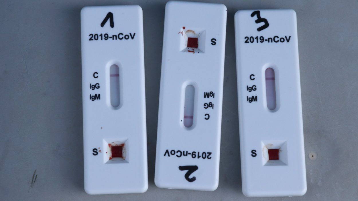 El govern espanyol dona llum verda a la venda de tests d'antígens a les farmàcies sense recepta