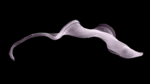 'El Pou' comença una sèrie d'entrevistes al Sincrotró Alba amb una investigació sobre la malaltia de la son