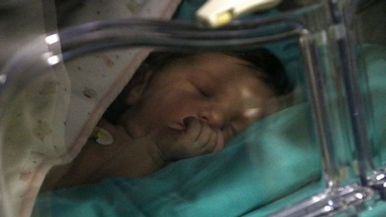 Un de cada tres parts a Sant Cugat és per cesària