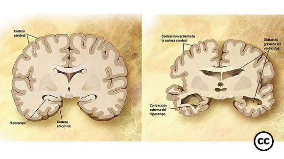 CiU i el PSC fan costat al PP en la moció per ampliar la partida de polítiques socials