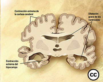 I aquest dimarts al magazín...